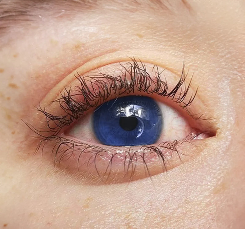 How to Fix Crooked Eyelashes