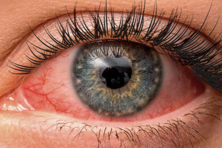 Eyelash Extension Risks: What You Need to Know Before Your Next Appointment